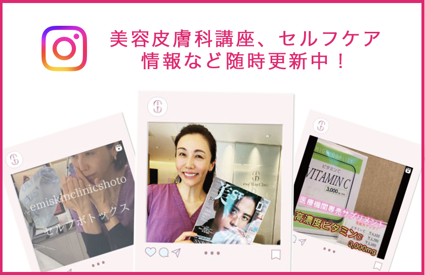 インスタグラム