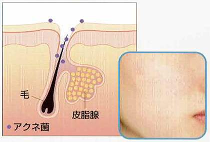 健康は肌
