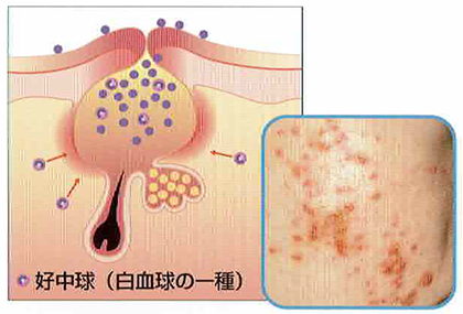 健康は肌